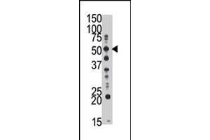 The GCNT1 polyclonal antibody  is used in Western blot to detect GCNT1 in mouse kidney tissue lysate . (GCNT1 Antikörper  (Internal Region))