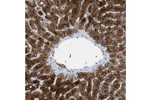 Immunohistochemical staining of human liver with ASGR1 polyclonal antibody  shows strong positivity in hepatocytes.