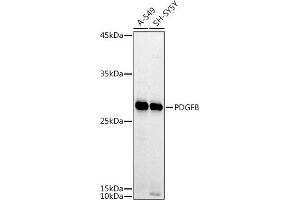 Western blot analysis of extracts of various cell lines, using PDGFB antibody (ABIN3021688, ABIN3021689, ABIN3021690 and ABIN6215511) at 1:1000 dilution. (PDGFB Antikörper  (AA 20-241))