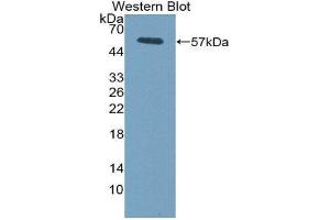 Western Blotting (WB) image for anti-Fc Fragment of IgG, Low Affinity IIIa, Receptor (CD16a) (FCGR3A) (AA 5-240) antibody (ABIN1858833)