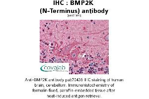 Image no. 1 for anti-BMP2 Inducible Kinase (BMP2K) (N-Term) antibody (ABIN1732361) (BMP2K Antikörper  (N-Term))