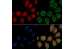 Phospho-IP3 Receptor (Ser1598) Antibody staining Hela cells(45 min of heat-shock treatment) by IF/ICC. (IP3 Receptor Antikörper  (pSer1598))