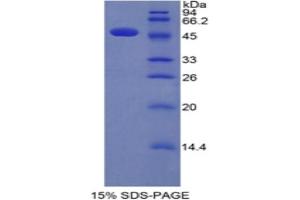 SDS-PAGE analysis of Human Interferon alpha Protein. (IFNA Protein)