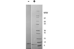 SDS-PAGE of Rat Epidermal Growth Factor Recombinant Protein SDS-PAGE of Rat Epidermal Growth Factor Recombinant Protein. (EGF Protein)