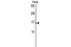 Western blot analysis of SNRPD2 Antibody (N-term) in Hela cell line lysates (35ug/lane). (SNRPD2 Antikörper  (N-Term))