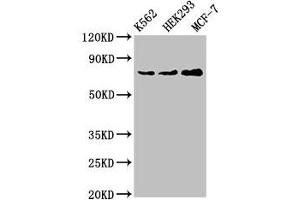 Western Blot Positive WB detected in: K562 whole cell lysate, HEK293 whole cell lysate, MCF-7 whole cell lysate All lanes: RALBP1 antibody at 4 μg/mL Secondary Goat polyclonal to rabbit IgG at 1/50000 dilution Predicted band size: 77 kDa Observed band size: 77 kDa (RALBP1 Antikörper  (AA 6-105))
