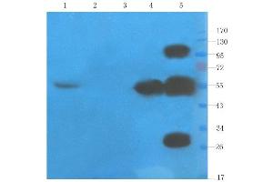 Western Blot using anti-TNFalpha antibody  Rat liver (lane 1), rat spinal cord (lane 2), mouse testis (lane 3), rat colon (lane 4) and human thyroid tumour (lane 5) samples were resolved on a 10% SDS PAGE gel and blots probed with  at 1 µg/ml before being detected by a secondary antibody.
