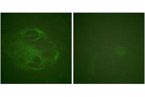 Immunofluorescence analysis of HeLa cells, using HRS (Ab-334) Antibody. (HRS (HRS) (AA 301-350) Antikörper)