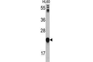 Western blot analysis of GLO1 antibody (N-term) in HL60 cell line lysates (35 µg/lane).