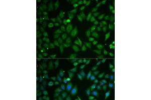 Immunofluorescence analysis of U2OS cells using SCG2 Polyclonal Antibody (SCG2 Antikörper)