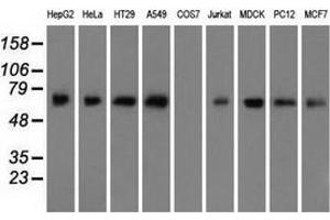 Western blot analysis of extracts (35 µg) from 9 different cell lines by using anti-ARNTL monoclonal antibody. (ARNTL Antikörper)