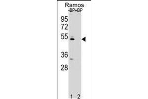 Western blot analysis of ZDHC2 Antibody Pab pre-incubated without(lane 1) and with(lane 2) blocking peptide in Ramos cell line lysate.