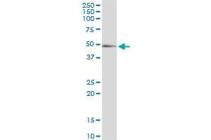 CTSD (Human) IP-WB Antibody Pair