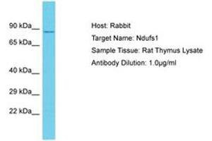 Image no. 1 for anti-NADH Dehydrogenase (Ubiquinone) Fe-S Protein 1, 75kDa (NADH-Coenzyme Q Reductase) (NDUFS1) (AA 88-137) antibody (ABIN6750362) (NDUFS1 Antikörper  (AA 88-137))