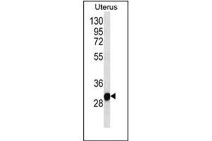 Western blot analysis of RNF148 Antibody (C-term) in Human normal Uterus cell line lysates (35ug/lane). (RNF148 Antikörper  (C-Term))