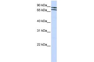 WB Suggested Anti-ZNF572 Antibody Titration:  0. (ZNF572 Antikörper  (N-Term))