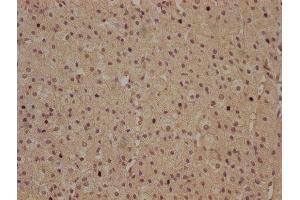 IHC image of ABIN7140118 diluted at 1:100 and staining in paraffin-embedded human adrenal gland tissue performed on a Leica BondTM system. (RHBDD3 Antikörper  (AA 304-323))