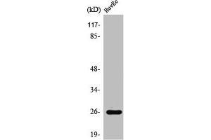 Western Blot analysis of COLO205 cells using Rab L2A Polyclonal Antibody