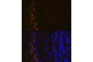 Immunofluorescence analysis of mouse brain using GluR2/GRI Rabbit mAb (ABIN7267414) at dilution of 1:100 (40x lens). (GRIA2 Antikörper)