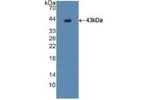 Detection of Recombinant ATP7b, Human using Polyclonal Antibody to ATPase, Cu++ Transporting Beta Polypeptide (ATP7b)