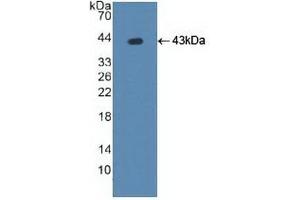 Detection of Recombinant ATP7b, Human using Polyclonal Antibody to ATPase, Cu++ Transporting Beta Polypeptide (ATP7b) (ATP7B Antikörper  (AA 59-426))