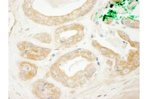 Immunohistochemistry (IHC) image for anti-ADP-Ribosylation Factor Guanine Nucleotide-Exchange Factor 2 (Brefeldin A-Inhibited) (ARFGEF2) (AA 300-350) antibody (ABIN7453665)