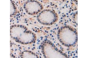 Immunohistochemistry (IHC) image for anti-TAF2 RNA Polymerase II, TATA Box Binding Protein (TBP)-Associated Factor, 150kDa (TAF2) (AA 918-1199) antibody (ABIN5014384)
