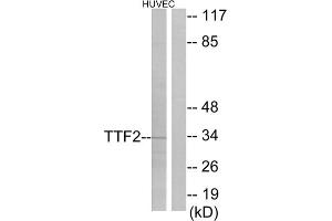 Western blot analysis of extracts from HUVEC cells, using TTF2 antibody. (TTF2 Antikörper  (N-Term))