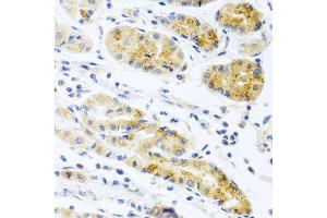 Immunohistochemistry of paraffin-embedded human stomach using PROK2 antibody at dilution of 1:100 (40x lens).