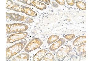 ABIN6258423 and ABIN6276238 at 1/100 staining Rat colorectal tissue by IHC-P. (GIPR Antikörper  (Internal Region))