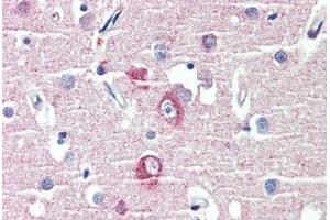 Brain, cortex, Human: Formalin-Fixed, Paraffin-Embedded (FFPE) (DLGAP1 Antikörper  (AA 391-405))