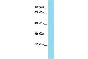 Host: Rabbit Target Name: CCDC120 Sample Type: Hela Whole cell lysates Antibody Dilution: 1. (CCDC120 Antikörper  (C-Term))