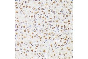 Immunohistochemistry of paraffin-embedded mouse spinal cord using XRCC2 Rabbit pAb  at dilution of 1:50 (40x lens).