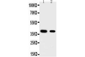 Anti-KLF5 antibody, Western blotting Lane 1: HELA Cell Lysate Lane 2: MCF-7 Cell Lysate (KLF5 Antikörper  (Middle Region))