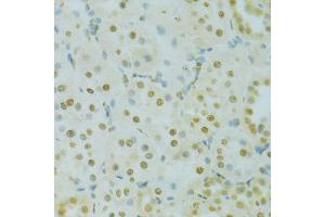 Immunohistochemistry of paraffin-embedded rat kidney using RCC1 antibody (ABIN5973761) at dilution of 1/100 (40x lens). (RCC1 Antikörper)