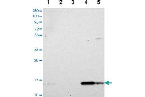Western blot analysis of Lane 1: RT-4 Lane 2: U-251 MG Lane 3: Human Plasma Lane 4: Liver Lane 5: Tonsil with DUSP23 polyclonal antibody . (DUSP23 Antikörper)