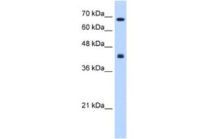 Western Blotting (WB) image for anti-Carbohydrate (N-Acetylgalactosamine 4-0) Sulfotransferase 8 (CHST8) antibody (ABIN2463289) (CHST8 Antikörper)