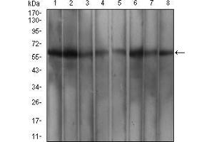 Western Blotting (WB) image for anti-Wilms Tumor 1 Associated Protein (WTAP) (AA 91-201) antibody (ABIN5542407)