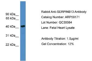 WB Suggested Anti-SERPINB13  Antibody Titration: 0.