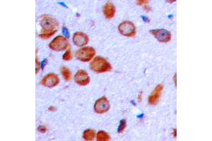 Immunohistochemical analysis of LT beta staining in human brain formalin fixed paraffin embedded tissue section. (LTB Antikörper  (C-Term))