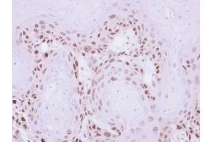 IHC-P Image Immunohistochemical analysis of paraffin-embedded Ca922 xenograft , using MAGEA11, antibody at 1:500 dilution. (MAGEA11 Antikörper  (N-Term))