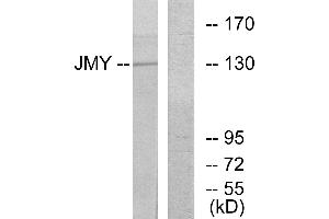 Western blot analysis of extracts from COLO cells, using JMY antibody. (JMY Antikörper  (Internal Region))