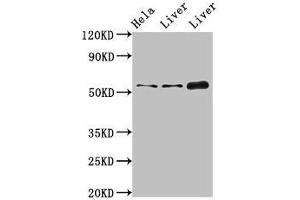 Western Blot Positive WB detected in: Hela whole cell lysate, Rat liver tissue, Mouse liver tissue All lanes: IFIT1 antibody at 4 μg/mL Secondary Goat polyclonal to rabbit IgG at 1/50000 dilution Predicted band size: 56, 52 kDa Observed band size: 56 kDa (IFIT1 Antikörper  (AA 1-181))
