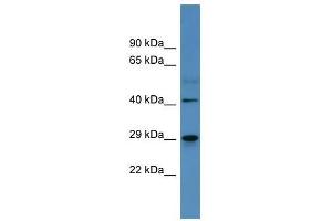 CA2 antibody used at 0. (CA2 Antikörper  (C-Term))