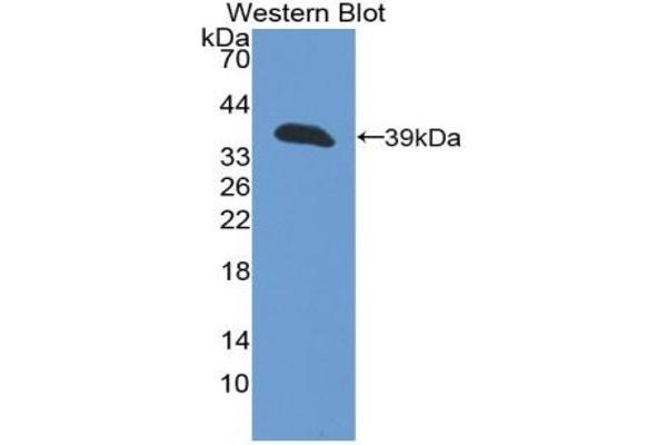 Cytokeratin 13 Antikörper  (AA 104-403)