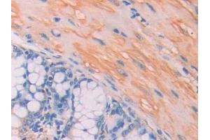 Detection of CA7 in Mouse Colon Tissue using Polyclonal Antibody to Carbonic Anhydrase VII (CA7) (CA7 Antikörper  (AA 58-217))
