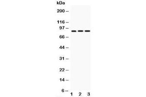 Western blot testing of CD18 antibody and Lane 1:  HeLa;  2: Jurkat;  3: HT1080;  Predicted/Observed size: 85~95KD depending on glycosylation level (Integrin beta 2 Antikörper  (N-Term))