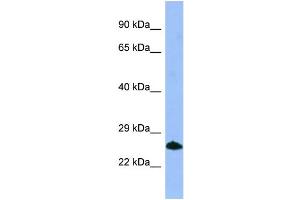 WB Suggested Anti-SMN1 Antibody Titration: 1. (SMN1 Antikörper  (C-Term))