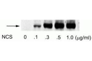 Western blot of human melanoma cells incubated with varying doses of the radiomimetic drug NCS showing specific immunolabeling of the ~74 kDa ATF2 protein phosphorylated at Ser490 and Ser498. (ATF2 Antikörper  (pSer490, pSer498))