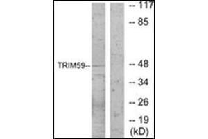 Western blot analysis of extracts from NIH-3T3 cells, using TRIM59 Antibody . (TRIM59 Antikörper  (Internal Region))